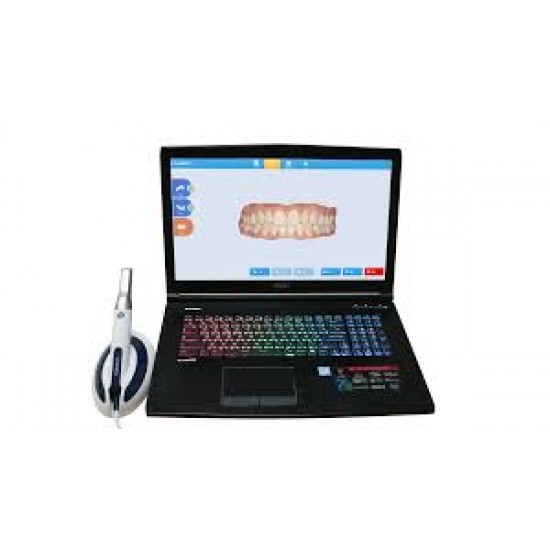 Intra Oral Scanner DL-100P Handpiece with Laptop LAUNCA Intra Oral Scanner Rs.859,375.00