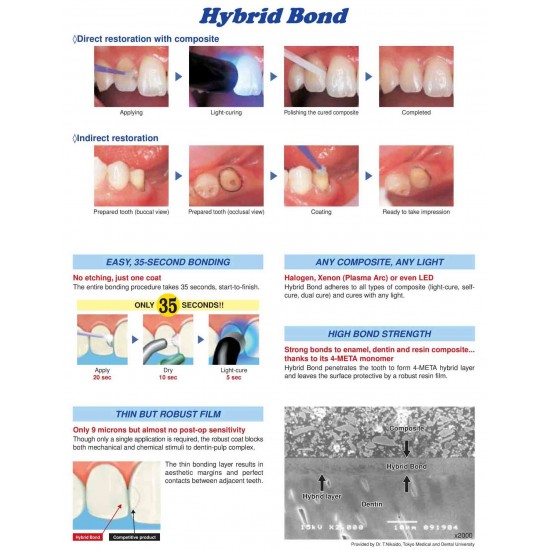 Hybrid Bond Sun Medical Endodontic Rs.2,500.00