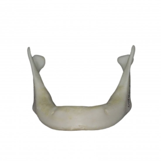 Completely Edentulous Mandible V-Invent Hands On Models Rs.2,856.19
