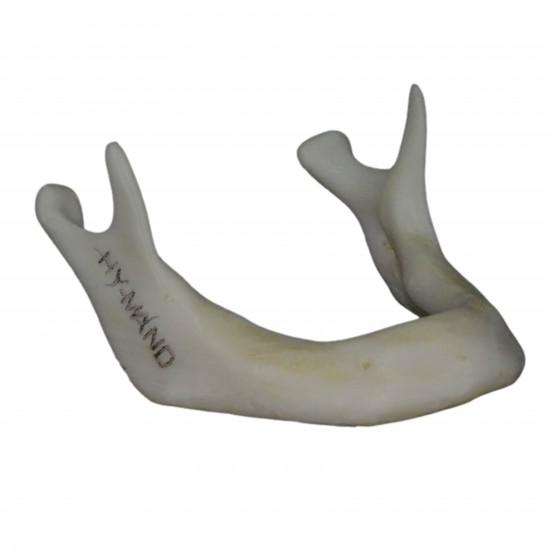 Completely Edentulous Mandible V-Invent Hands On Models Rs.2,856.19