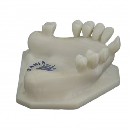 Partially Edentulous Maxilla V-Invent Hands On Models Rs.2,856.19