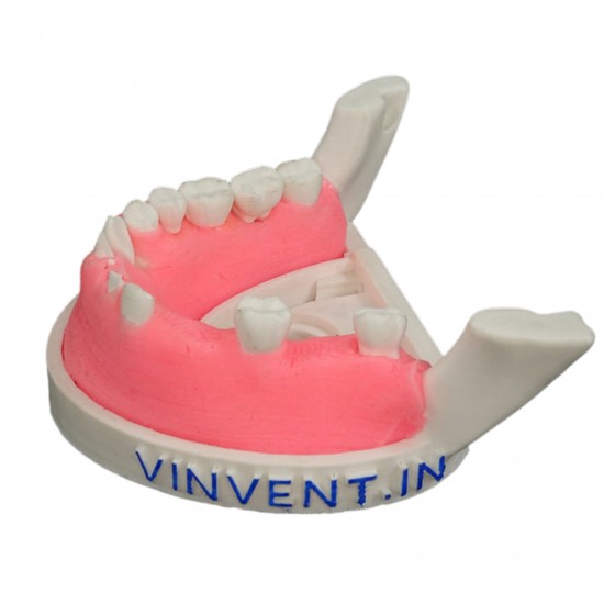 Periomount V-Invent Hands On Models Rs.3,332.38