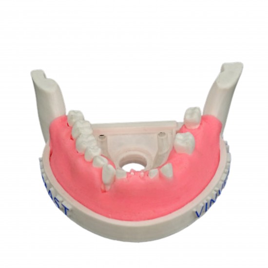 Periomount Periomount V-Invent Hands On Models Rs.3,332.38
