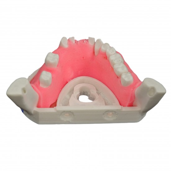 Periomount Periomount V-Invent Hands On Models Rs.3,332.38