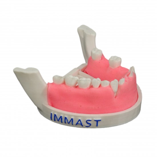 Periomount Periomount V-Invent Hands On Models Rs.3,332.38