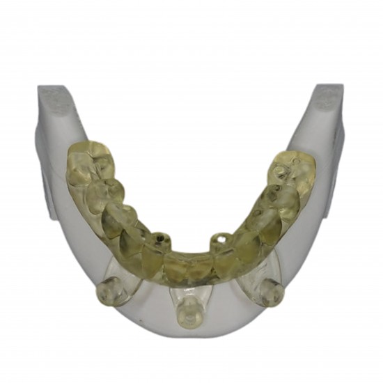 Surgical Stents V-Invent Hands On Models Rs.2,380.00