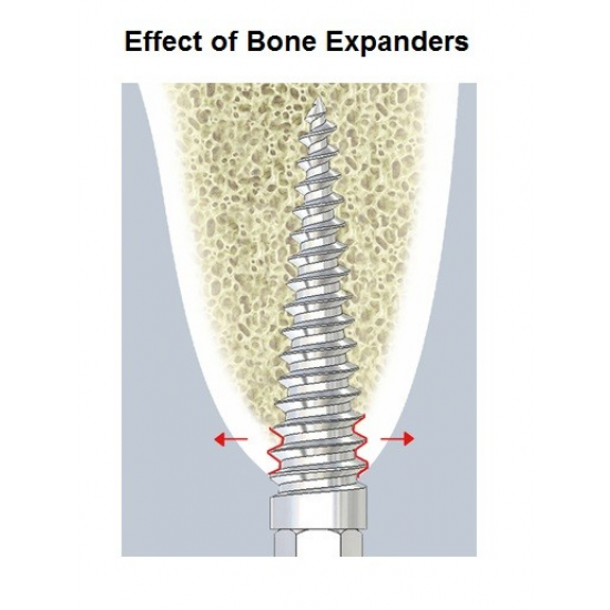 Bone Expander Set of 12 WALDENT Dental Instruments Rs.17,857.14