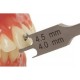 Bracket Height Gauge Bracket Height Gauge WALDENT Dental Instruments Rs.625.00