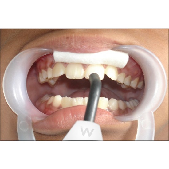 Electric Pulp Tester WALDENT Dental Instruments Rs.8,928.57