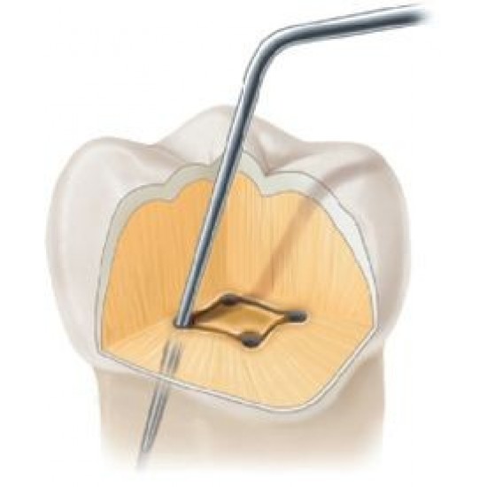 Endodontic Explorer DG 16 WALDENT Dental Instruments Rs.223.21