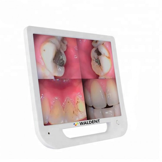 Intra Oral Camera With Monitor - Ergo WALDENT Intra Oral Camera Rs.20,982.14