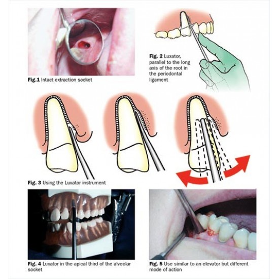 Luxators Set WALDENT Dental Instruments Rs.9,910.71