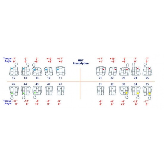 Metal Bracket Kit MBT Metal Bracket Kit MBT WALDENT Dental Instruments Rs.714.28