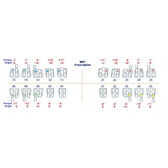 Metal Bracket Kit MBT WALDENT Dental Instruments Rs.714.28