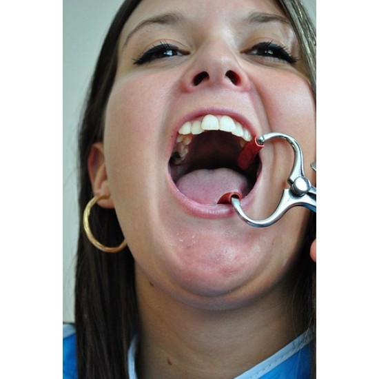 Mouth Gag Molt For Adult Mouth Gag Molt For Adult WALDENT Dental Instruments Rs.2,589.28
