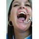 Mouth Gag Molt For Adult Mouth Gag Molt For Adult WALDENT Dental Instruments Rs.2,589.28