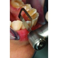 Orthodontic Inter-Proximal Reduction Kit