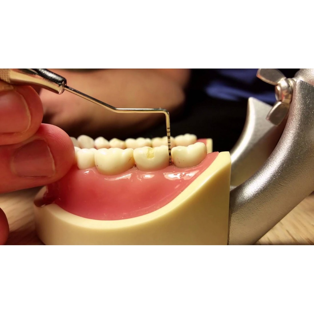 Buy Periodontal Probes WALDENT Online at Lowest Best Price