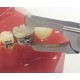 Posterior Band Remover Short TC WALDENT Dental Instruments Rs.2,821.42
